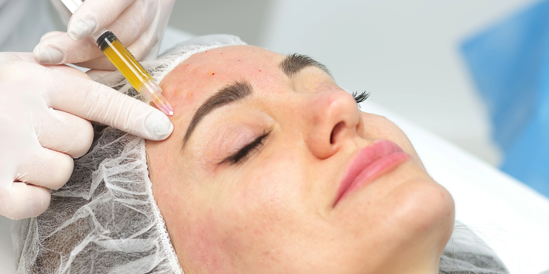 Vampire Facial (PRP) – Aliza Clinic Oshiwara